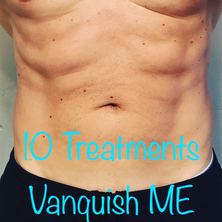 Vanquish-ME-Gainesville-FL-10-Treatments