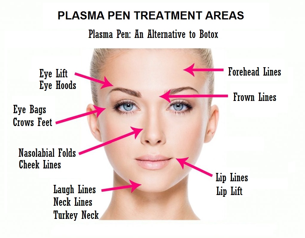 Plasma Pen for Face Wrinkles
