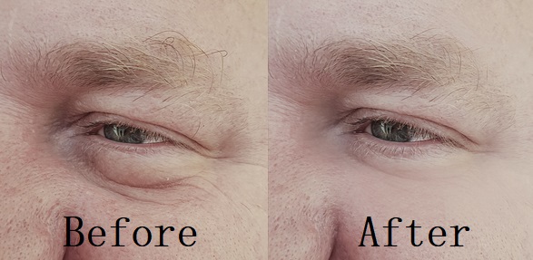 Best Eye Cream for Wrinkles